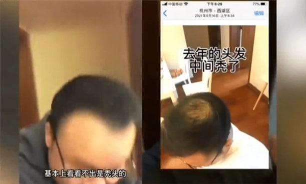 男子回應(yīng)“不用洗發(fā)水變滿頭黑發(fā)”