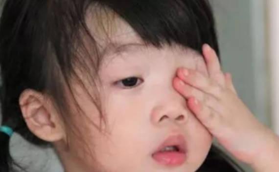 麻痹性斜視的原因是什么？