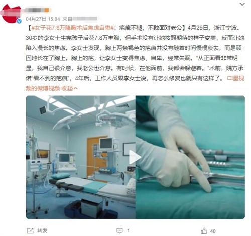 女子花7.8萬(wàn)豐胸手術(shù)后焦慮自卑，疤痕難以修復(fù)