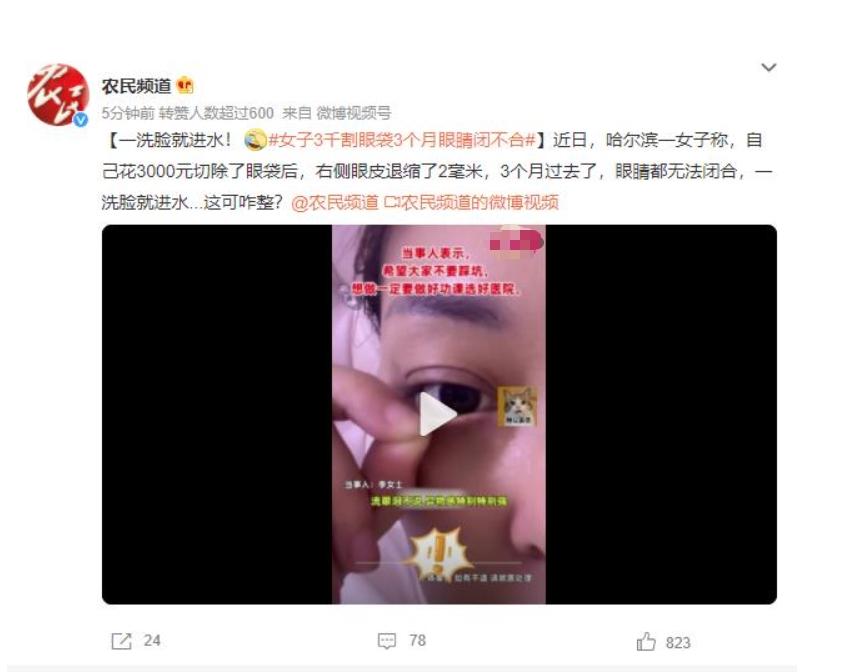 眼袋手術(shù)后3個(gè)月眼睛閉不合，女子苦惱洗臉進(jìn)水該如何解決？
