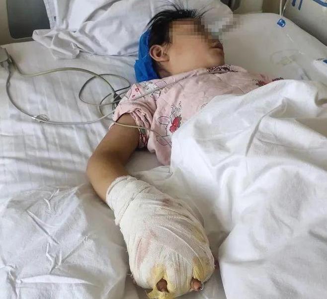 甘肅女童遭繼母虐待致殘，父親堅決追究，警方已介入調(diào)查